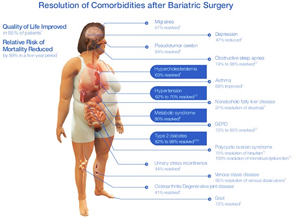 comorbidities after bariatric surgery