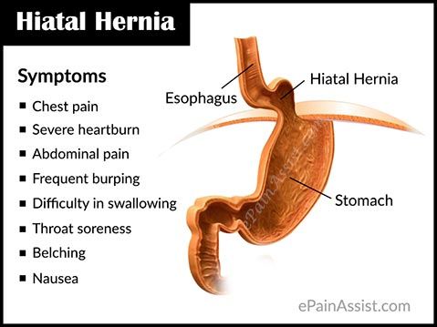 Hiatal Hernia Repair-Get Best Treatment by Freedom From Obesity 